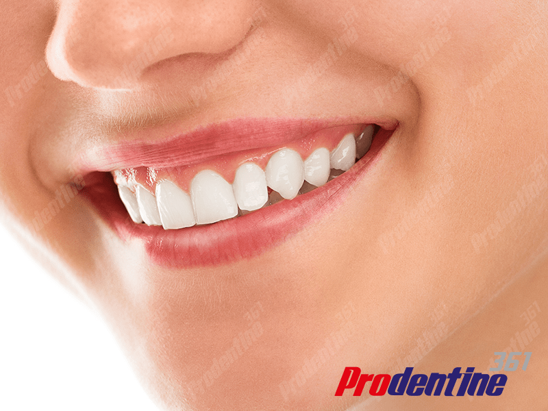 روش های مختلف برای سفید کردن دندان ها
