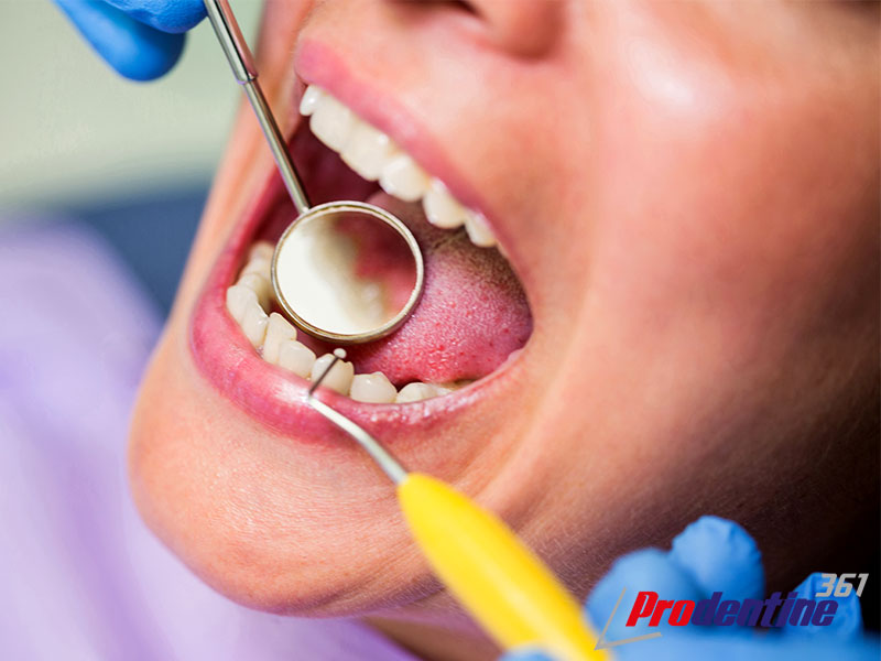 مراحل پوسیدگی دندان چیست و چگونه باید از آن پیشگیری کرد؟